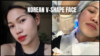 HOW TO ACHIEVE KOREAN VSHAPE FACE  EXILIS REVIEW [upl. by Chrisy]