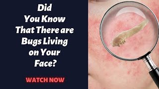 Uncovering The Truth About Demodex Mites On Face [upl. by Igig]