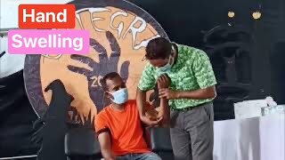 Swelling on hand  surgery case  bangla [upl. by Aneehsak459]