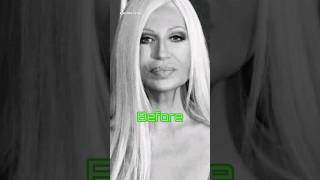 Donatella Versace Before and Afterversace donatellaversaceitaly [upl. by Idelle]