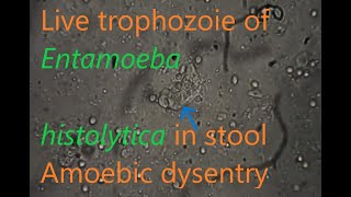 Entamoeba histolytica trophozoite in stool [upl. by Jagir]