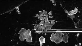 3 Methods for Passaging of Pluripotent Stem Cells [upl. by Jochbed229]