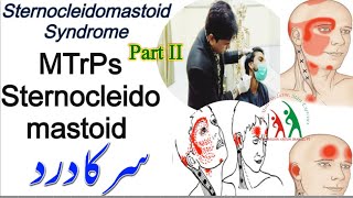 STERNOCLEIDOMASTOID SYNDROMEMYOFICAIL TRIGGER POINTS SCM PART IIDry Needlingسر کا دردSCALP PAIN [upl. by Ethelinda]