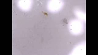 Copepods under a 200x Microscope [upl. by Brost]