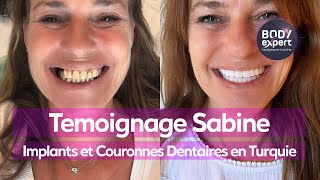 SOINS DENTAIRES  🦷 Témoignage Sabine  8 implants  22 couronnes dentaires Emax  BODYEXPERT [upl. by Einahc]