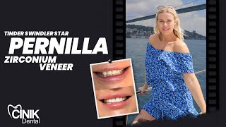 Tinder Swindler Star Pernilla Zirconium Veneer  Cinik Dental [upl. by Emmet335]