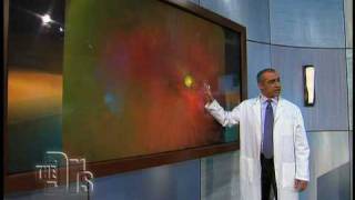 The Optomap® Retinal Exam on The Doctors [upl. by Sidran]