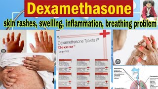 Dexona tablet  किस काम आती है  Dexamethasone tablets ip 05 mg uses in hindi [upl. by Paterson]