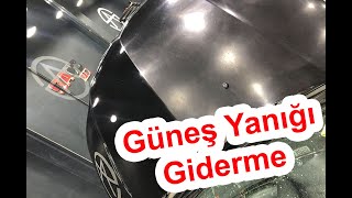 Güneş Yanığı Giderme Uygulaması [upl. by Adnot412]