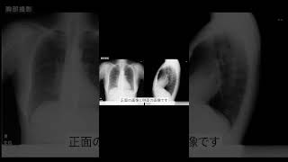 ～トリカタ〜胸部レントゲンの撮影方法①〜 現役の放射線技師が解説！レントゲン放射線技師 医療 胸部 shorts [upl. by Hube859]