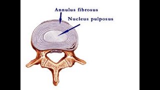 Lumbar Spine Disc Herniation and Disc Bulge Anatomy [upl. by Eicyac776]