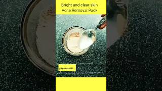 🔥How To Remove Acne In A Weekacne acnetreatment shorts ytshorts AyatAnsari88 [upl. by Slohcin566]