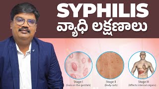 Syphilis  Syphilis Disease Symptoms Prevention and Homeopathy Treatment  NeogeneticHomeopathy [upl. by Eiger]