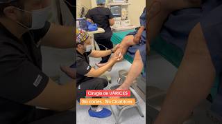 🏩 Cirugía de Várices venasvaricosas varices escleroterapia arañasvenenosas [upl. by Antrim]