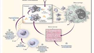 Managing Single Organ SLEITP [upl. by Ethelin]