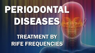 Periodontal Diseases  RIFE Frequencies Treatment  Energy amp Quantum Medicine with Bioresonance [upl. by Aanas]