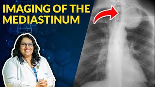 Imaging of Mediastinum Radiological Anatomy  Dr Avni Skandhan MD [upl. by Lednek]