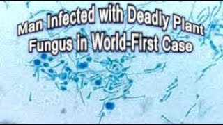 Man infected with deadly plant fungus in world first case [upl. by Anyal]