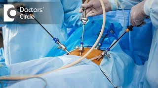 5 benefits of Gynaec Laparoscopic Surgery  Dr Shafalika Boriah [upl. by Salomo]