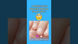 ¿PORQUÉ SALEN MANCHAS BLANCAS EN LAS UÑAS [upl. by Shandra]