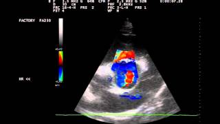 Herzultraschall Aortenklappeninsuffizienz beim Pferd [upl. by Chassin]
