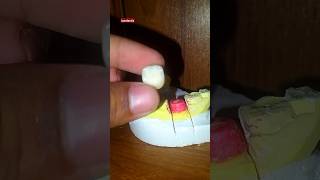 Singel ceramics cap shortvideo dental teeth satisfying [upl. by Anna-Diane]