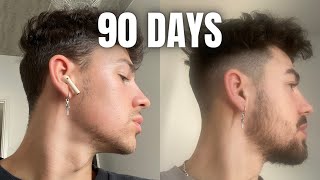 How To GROW A BEARD In 90 Days Using MINOXIDIL amp DERMA ROLLER [upl. by Ardyth320]