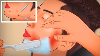 ASMR Shaving and Ingrown Hair Removal Animation Tingle Sound [upl. by Yokum261]