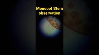 monocot Stem identification under microscope botany Practical shorts [upl. by Lyn]