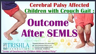 Cerebral Palsy Affected Children with Crouch Gait  Outcome After SEMLS  Trishla Foundation [upl. by Caitlin558]