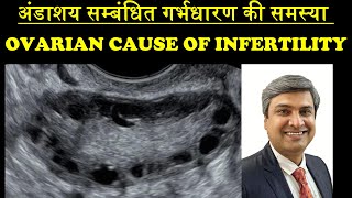 अंडाशय सम्बंधित गर्भधारण की समस्या  OVARIAN CAUSE OF INFERTILITY [upl. by Ardnuek]