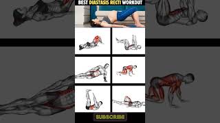 6 Best Diastasis Recti Workout Routine workout diastasisrectiexercises [upl. by Maker]