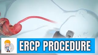 ERCP Endoscopic Retrograde Cholangiopancreatography procedure in 3D [upl. by Haidabej]