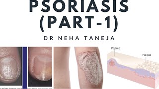 Papulosquamous disorders and PsoriasisPart1 [upl. by Bergmans]