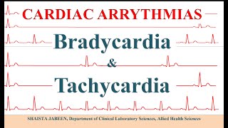 Bradycardia amp Tachycardia  Cardiac Arrhythmias  Chronotropic Action of Heart  Cardiac Physiology [upl. by Ahsinel]