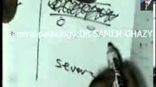 general pathology 6  inflammation 6 suppurative inflammation2 by DR SAMEH GHAZY [upl. by Leynwad691]