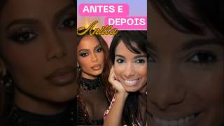 CANTORA ANITTA ANTES E DEPOISanitta foryou noticias fortoupage antesedepois musica fyp [upl. by Antonio729]