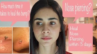 Nose Piercing Aftercare  Nose Pin or Nose Ring  Quick Heal [upl. by Nylatsirhc]