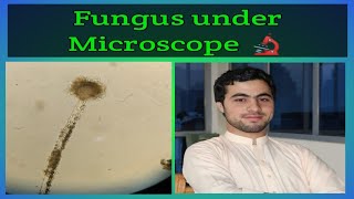 Fungus Under Microscope 🔬Elearn with Technologist [upl. by Bunde]