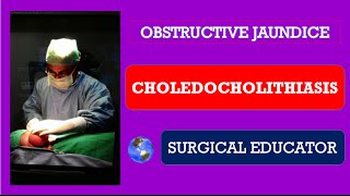 CHOLEDOCHOLITHIASISHow To DIAGNOSE amp TREAT Obstructive Jaundice [upl. by Arretak]