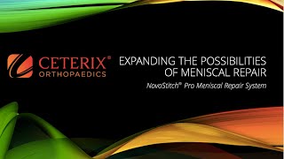 Ceterix Expanding the Possibilities of Meniscal Repair [upl. by Seabrooke]