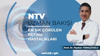 En Sık Görülen Retina Hastalıkları  Prof Dr Peykan TÜRKÇÜOĞLU  NTV Uzman Bakışı [upl. by Aleta]