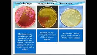 Microbiology  Practical Examination of urogenital specimens  Dr Eman [upl. by Buna]