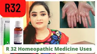 Pulsatilla Part 1  Uses amp Symptoms in Homeopathy by Dr PS Tiwari [upl. by Eva]