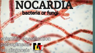 Nocardia ।। IntroductionScientific Classification Pathogenesis Laboratory Diagnosis of Nocardia [upl. by Bea]