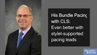 His Bundle Pacing with CLS Even better with styletsupported pacing leads [upl. by Marrilee]