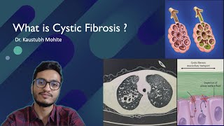 What is Cystic Fibrosis   Pathogenesis at cellular level Dr Kaustubh Mohite [upl. by Ennairrac]