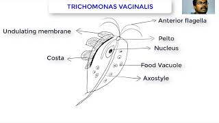 Trichomonas vaginalis [upl. by Erskine]