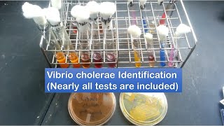 Vibrio cholerae identification  A to Z tests [upl. by Jere]