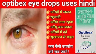 carboxymethylcellulose sodium eye drops  optibex tear eye drops Uses in Hindi [upl. by Nahtal425]